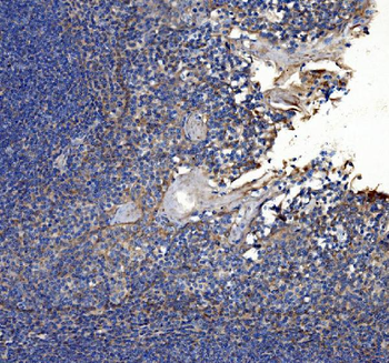 Collagen VII/COL7A1 Antibody