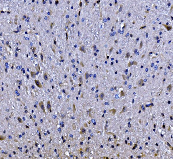 EEF2/Elongation factor 2 Antibody