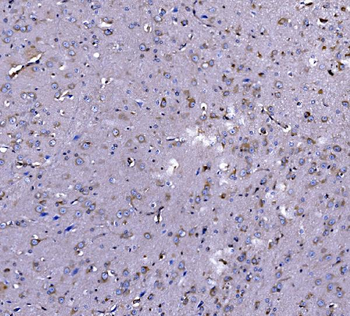 EEF2/Elongation factor 2 Antibody