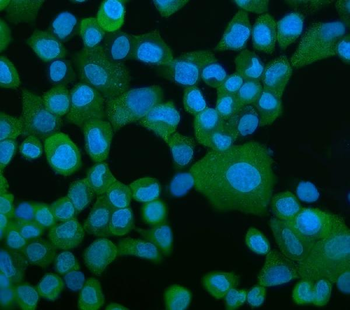 EEF2/Elongation factor 2 Antibody