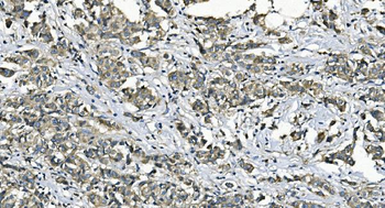 EEF2/Elongation factor 2 Antibody