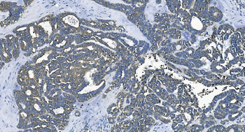 EEF2/Elongation factor 2 Antibody
