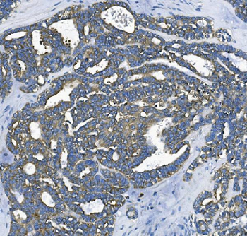 EEF2/Elongation factor 2 Antibody