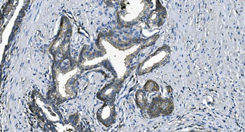 EEF2/Elongation factor 2 Antibody