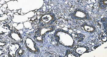 EEF2/Elongation factor 2 Antibody