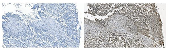 GRSF1 Antibody
