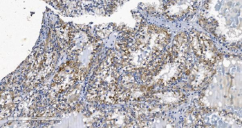 KCNQ5 Rabbit Polyclonal Antibody