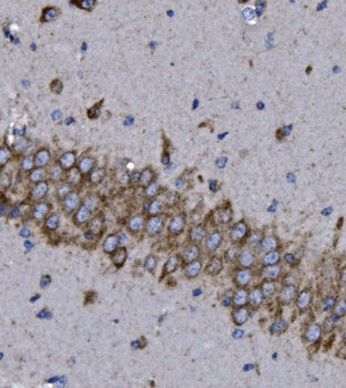 KCNQ5 Rabbit Polyclonal Antibody