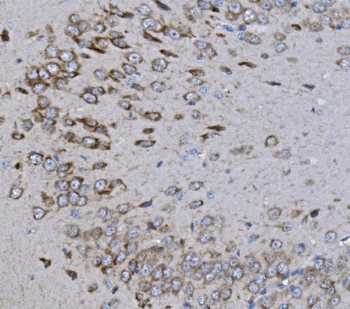 KCNQ5 Rabbit Polyclonal Antibody