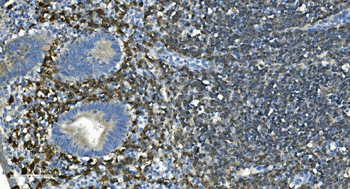 CD20/MS4A1 Antibody