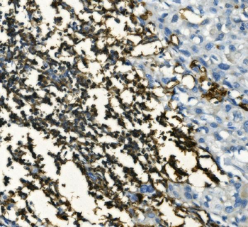 CD20/MS4A1 Antibody