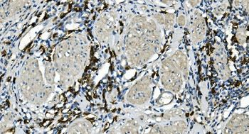 CD20/MS4A1 Antibody