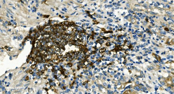CD20/MS4A1 Antibody