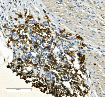 CD20/MS4A1 Antibody
