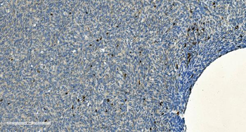 CD20/MS4A1 Antibody