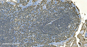 CD20/MS4A1 Antibody