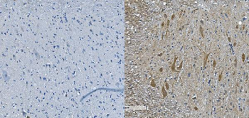 Nefh Rabbit Polyclonal Antibody