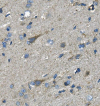 Nefh Rabbit Polyclonal Antibody