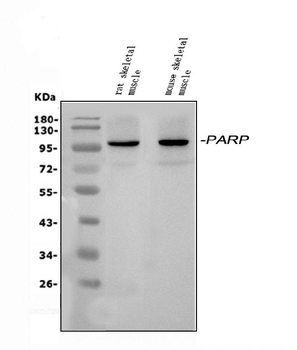 PARP9 Rabbit Polyclonal Antibody