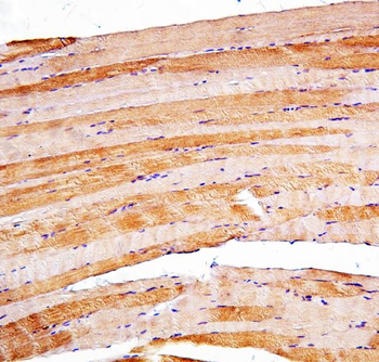 Presenilin 2/AD5/PSEN2 Rabbit Polyclonal Antibody