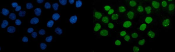 PARP/PARP1 Antibody (monoclonal, 2I2H4)