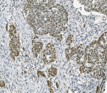 PARP/PARP1 Antibody (monoclonal, 2I2H4)