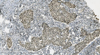 PARP/PARP1 Antibody (monoclonal, 2I2H4)