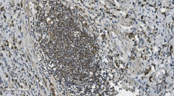 PARP/PARP1 Antibody (monoclonal, 2I2H4)