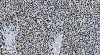 PARP/PARP1 Antibody (monoclonal, 2I2H4)