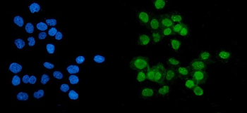 PARP/PARP1 Antibody (monoclonal, 10E11)