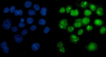 PARP/PARP1 Antibody (monoclonal, 10G9)