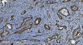 PARP/PARP1 Antibody (monoclonal, 10G9)