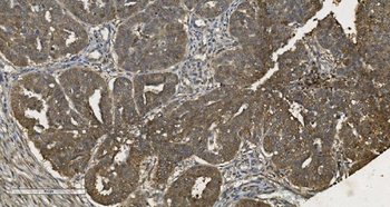 MPI Mouse Monoclonal Antibody