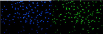 Transketolase/TKT Antibody (monoclonal, 3E5)