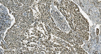Transketolase/TKT Antibody (monoclonal, 3E5)