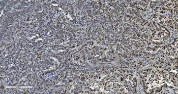 Transketolase/TKT Antibody (monoclonal, 3E5)