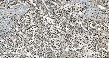 Transketolase/TKT Antibody (monoclonal, 3E5)