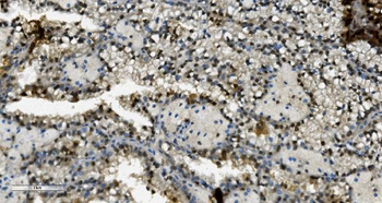Transketolase/TKT Antibody (monoclonal, 3E5)