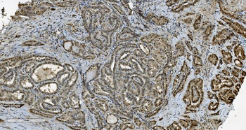Transketolase/TKT Antibody (monoclonal, 3E5)