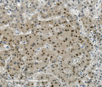 Transketolase/TKT Antibody (monoclonal, 2I3)