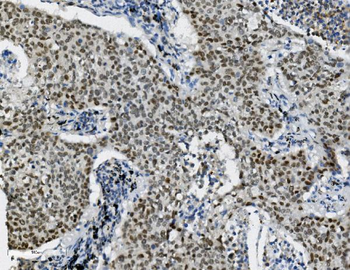 Transketolase/TKT Antibody (monoclonal, 2I3)