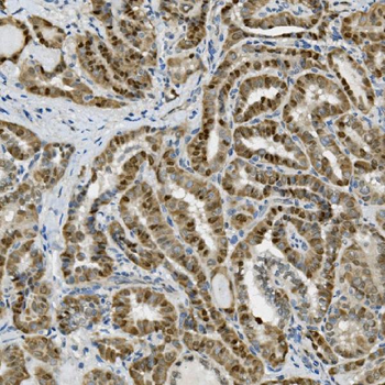 Transketolase/TKT Antibody (monoclonal, 2I3)