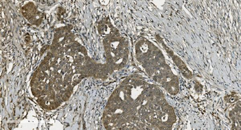 U2AF65/U2AF2 Antibody (monoclonal, 10F4)
