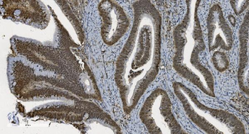 U2AF65/U2AF2 Antibody (monoclonal, 10F4)