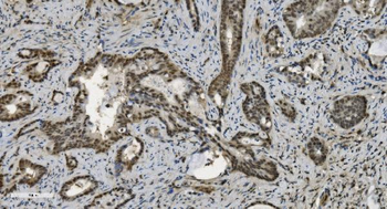 U2AF65/U2AF2 Antibody (monoclonal, 10F4)