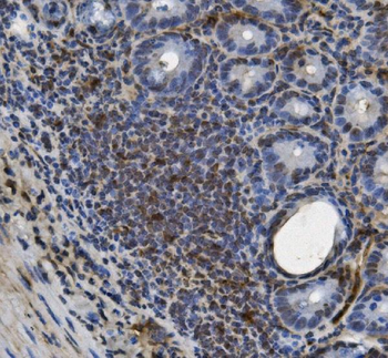 U2AF65/U2AF2 Antibody (monoclonal, 3G9)