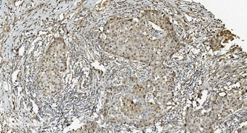 MCM5 Mouse Monoclonal Antibody