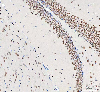 DDX1 Antibody (monoclonal, 3I10)
