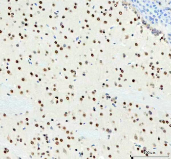 DDX1 Antibody (monoclonal, 3I10)