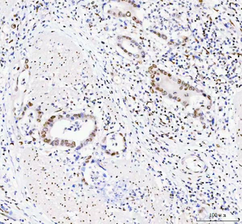 DDX1 Antibody (monoclonal, 3I10)